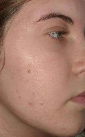 After image
