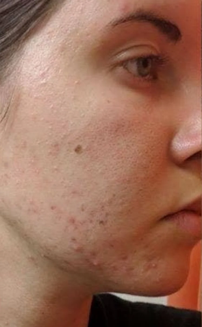Before image